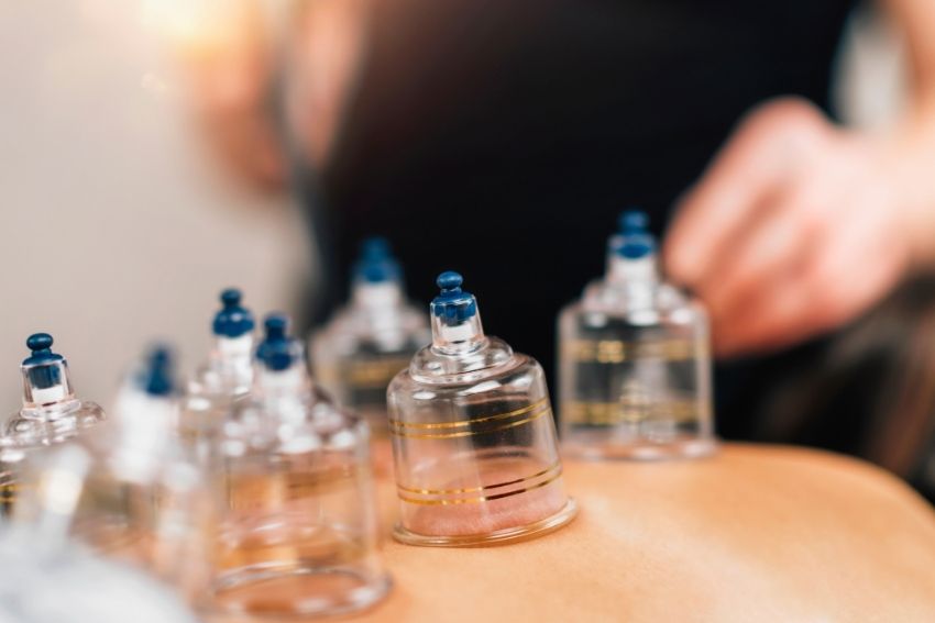 Dry Cupping Therapy
